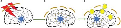 Brain metastases and lung cancer: molecular biology, natural history, prediction of response and efficacy of immunotherapy
